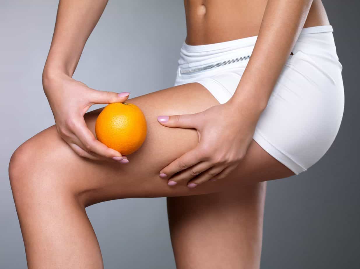 Proven exercises for thigh and buttock cellulite